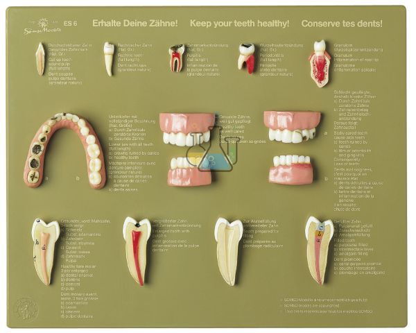 Display case "Keep Your Teeth" Model